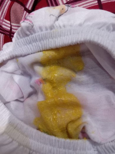 Poop bayi umur 2 bulan seperti ini