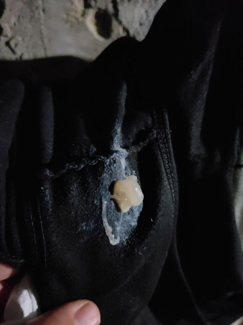 ตกขาวหรือมูกใส