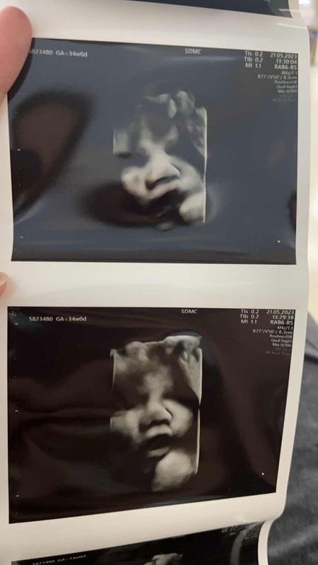 ลูกดูอ้วนในภาพ 4มิติ