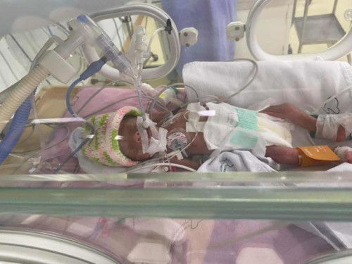 แชร์ประสบการณ์คลอดก่อนกำหนด