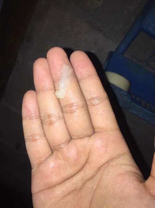 มีมูกใสออกมา