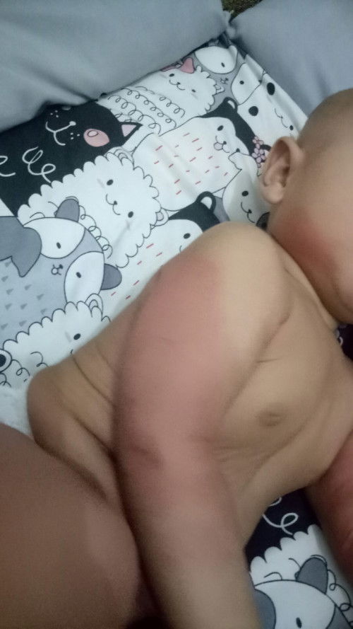 adakah disini yang baby nya alergi susu sapi??