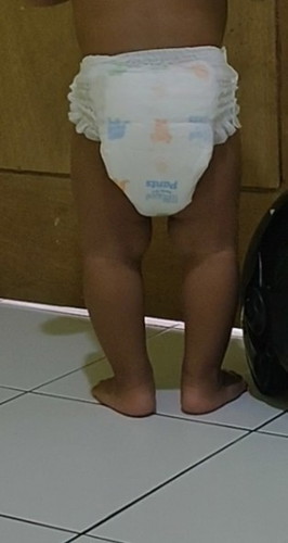 Bun , permisi . Maaf mau tanya ini anakku kaki nya letter o atau tidak ya ? Umur 15 bulan .