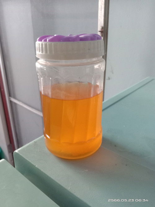 35+3 ปวดท้องเป็นพักๆ