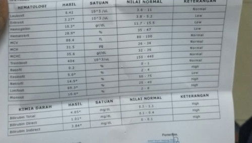 Bun tolong sharing pengalaman bunda tentang bilirubin bun