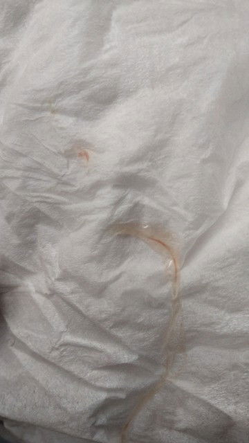 Bun, pagi tadi aku keluar gini kehamilan 39w4d apakah ini ciri mau melahirkan..