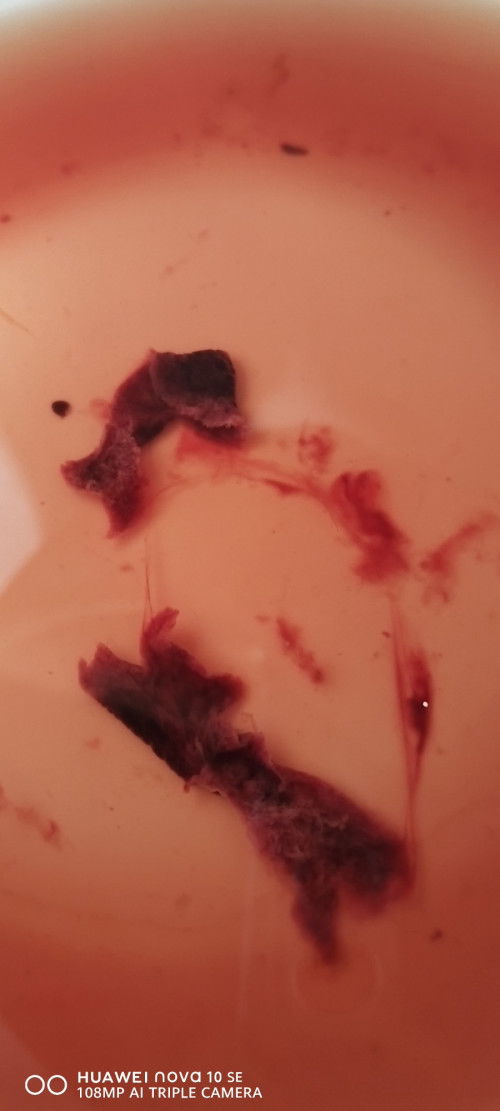 3rd Menstration period after miscarriage.