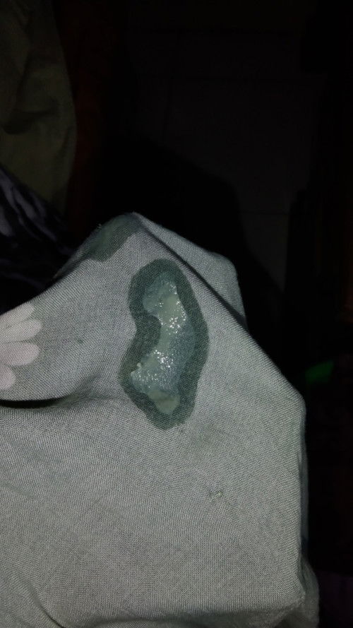 Keputihan banyak saat hamil masuk 25 minggu