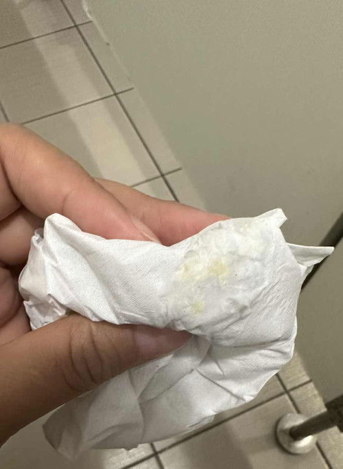 แบบนี้คืออะไรค่ะ พึ่งเป็นคาะ 13w