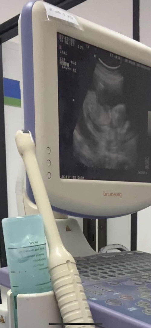 ดูเพศหมอซ่วแล้วไม่ได้บอกคะ