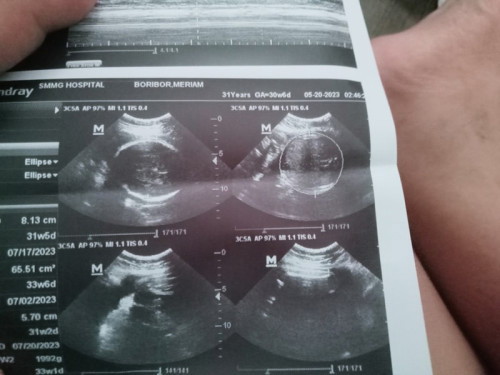 Sinong team july dito at first time mommy alam nyo naba gender ?☺️