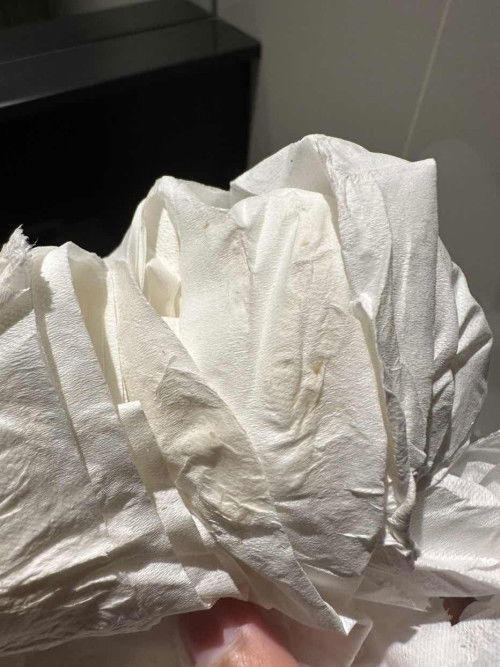 ตกขาวสีชมพูปกติไหมคะ ท้อง7สัปดาห์