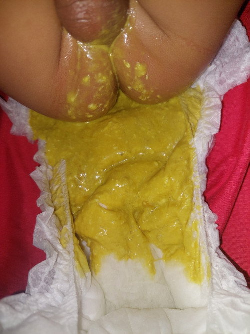 Pup bayi 5 bulan