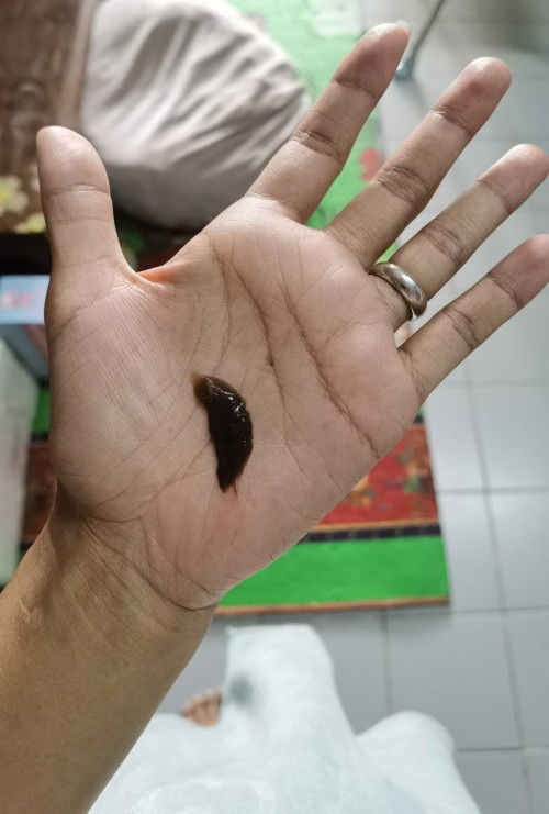 มีมูกสีน้ำตาลออกมา 37+6