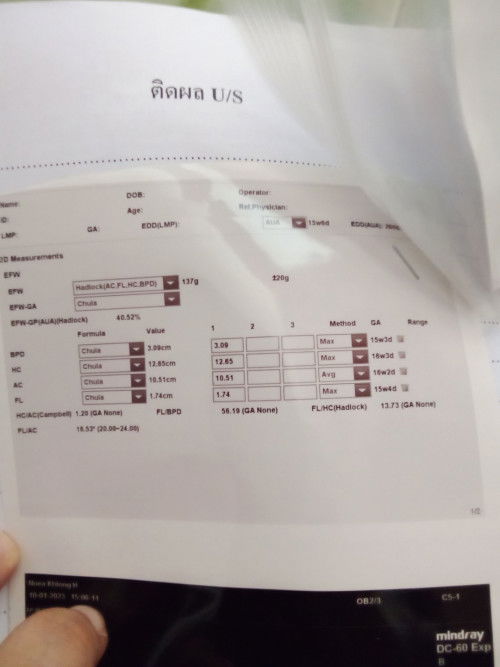 ท้องแรกจ้าา