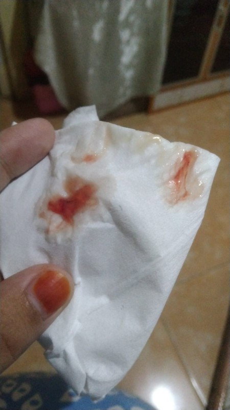 Pembukaan Tidak Bertambah²