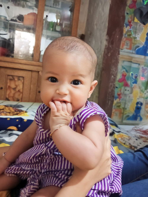 Lekungan di kepala bayi
