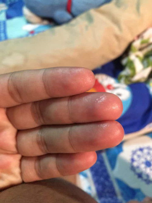 ขอสอบถามหน่อยค่ะตอนนี้39วีคแล้วมีน้ำเมื่อกๆแบบนี้บางทีก้เป็นน้ำเลยออกจากช่องคลอดแบบนี้มันคือน้ำเดินหรือตกขาวคะ