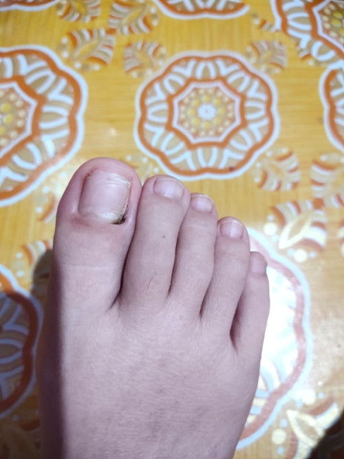 Kuku Hitam setelah melahirkan