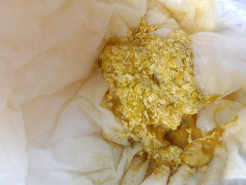 ลูก7เดือนกว่า ถ่ายบ่อยผิดปกติ