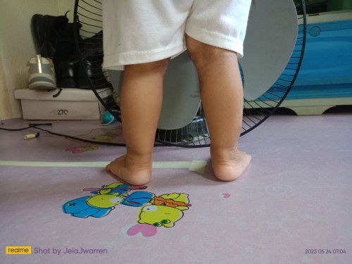 Flat Footed po ba si Baby? 1yr and 3mos na po siya.