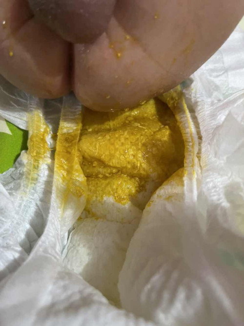 Newborn Poop
