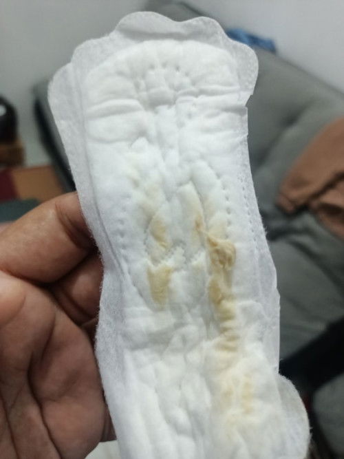 Keputihan gk sembuh2