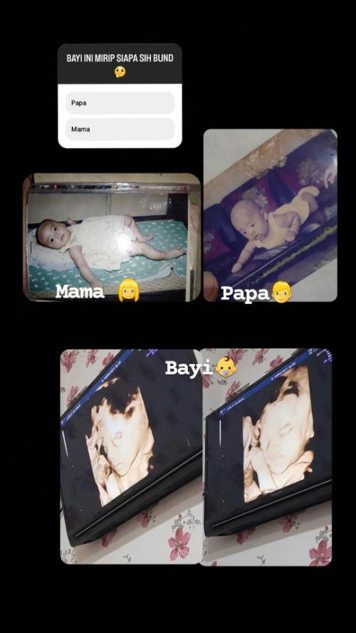 Anak saya mirip saya atau papanya ya bund?