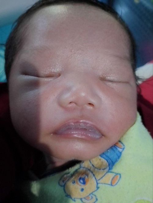bibir bayi putih pucat