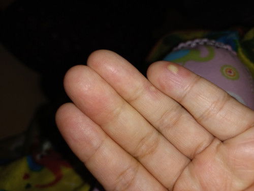 Ini knp ya?? Kulit sakit