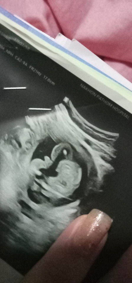 แม่ๆช่วยดูหน่อยค่ะ หญิงรึชาย