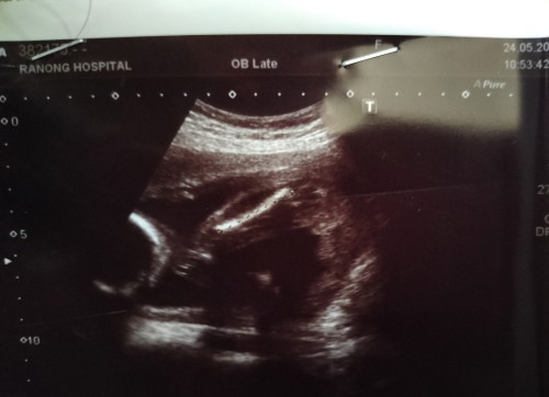 ให้แม่ๆช่วยดูให้หน่อยค่ะ