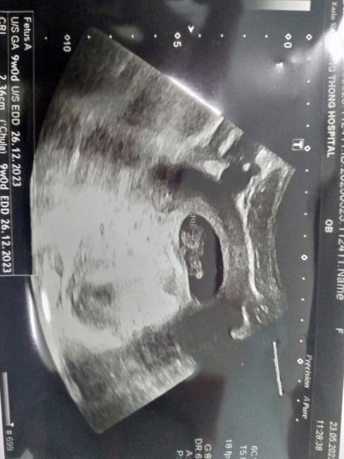 ท้อง9+4 w ปวดท้องจี๊ดๆ