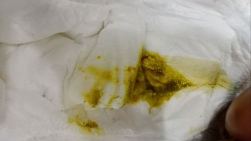 Diare pada bayi 4 bulan