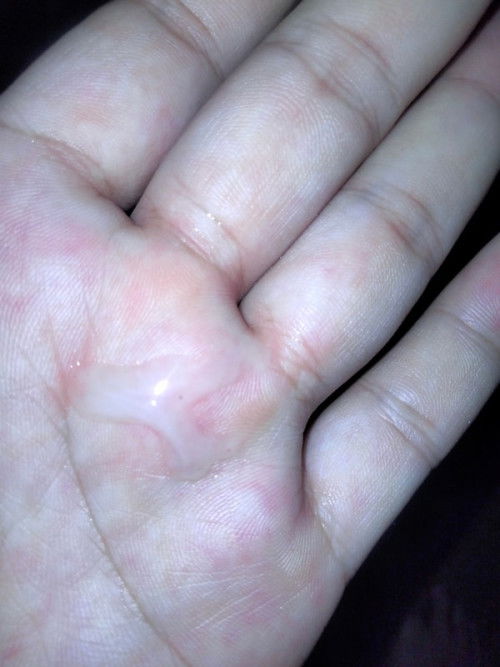 35+4 สัปดาห์