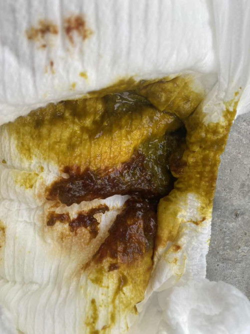 สอบถามหน่อยค่ะเเม่ๆภาพอาจจะไม่ค่อยเหมาะนะคะ