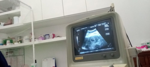 เจอแต่ถุงตั้งครรภ์