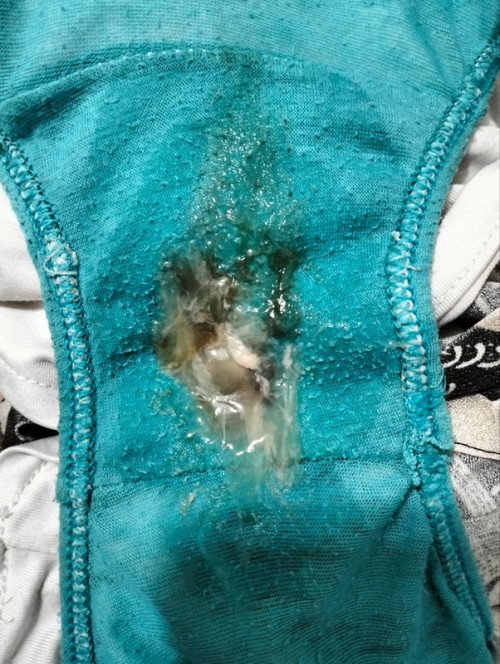Mucus plug