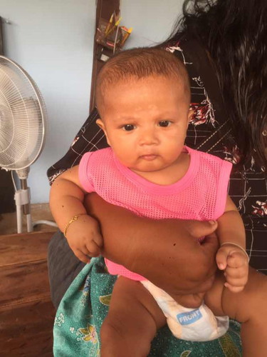 ลูกหัวใหญ่ หัวโต