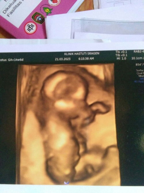 Mau tanya bunda" USG di foto ini brpa D ya .