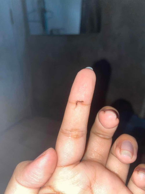 ตั้งครรภ์ได้ประมาน4สัปดาห์กว่าๆ😔