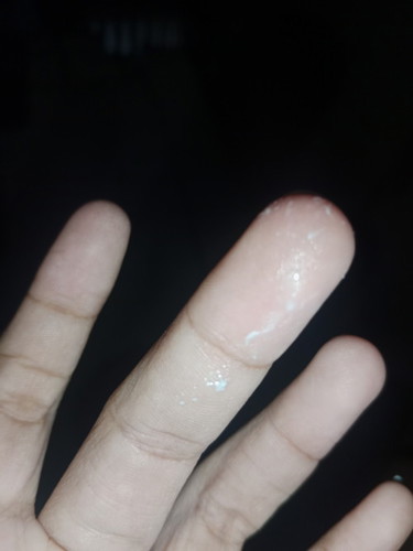 Mga momshie ano po kaya to lumalabas sa pwerta ko 13 weeks na po akong preggy di po sya mabaho