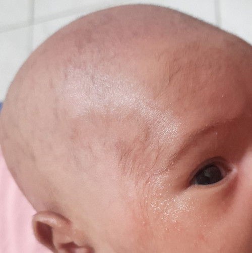 Bintik bintik di sekitar mata dan bibir bayi