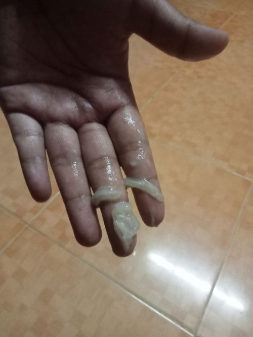 มีแบบนี้ออกมาต้องไปหาหมอมั้ยค่ะ มีอาการท้องปั้นร่วมด้วยค่ะ