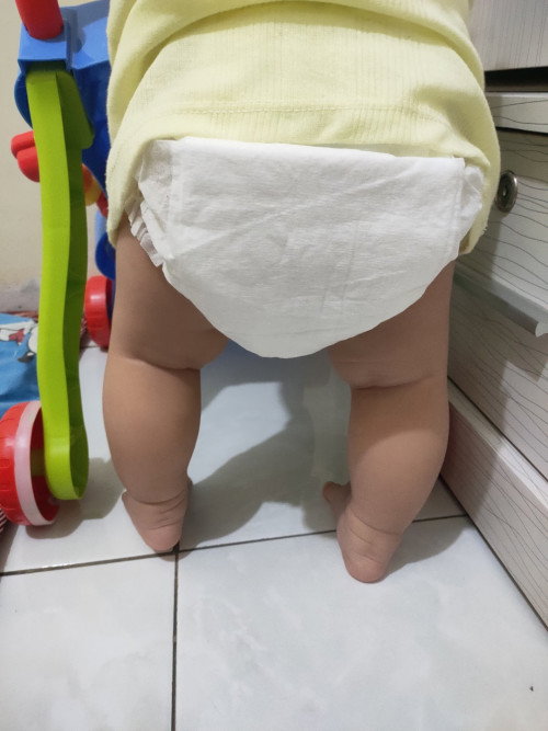 Kaki bentuk O