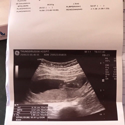 ช่วยดูเพศน้องหน่อยค่ะ 16w+6d