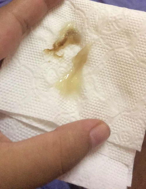 สอบถามแม่ๆหน่อยค่ะ