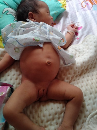 ลูกท้องใหญ่มาก