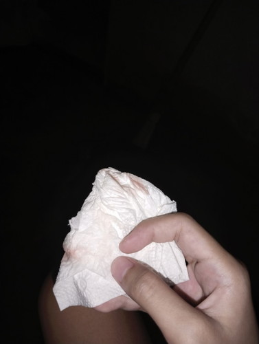 มีเลือดออก😢