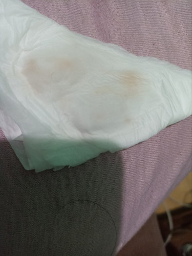 Bunda ini flek apa bukan ya